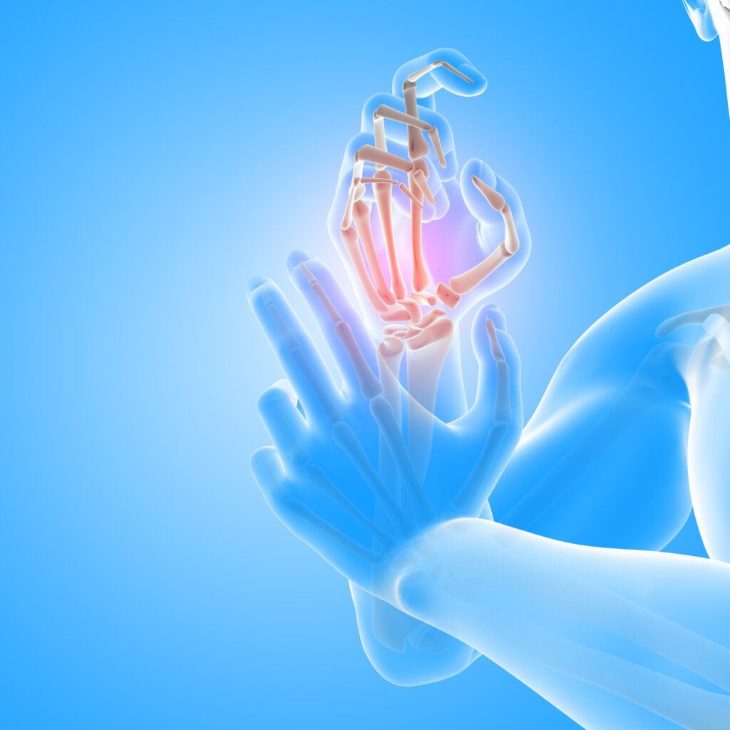 How Can Vitamin D Help Relieve Your Rheumatoid Arthritis? How Can Vitamin D Help Relieve Your Rheumatoid Arthritis?