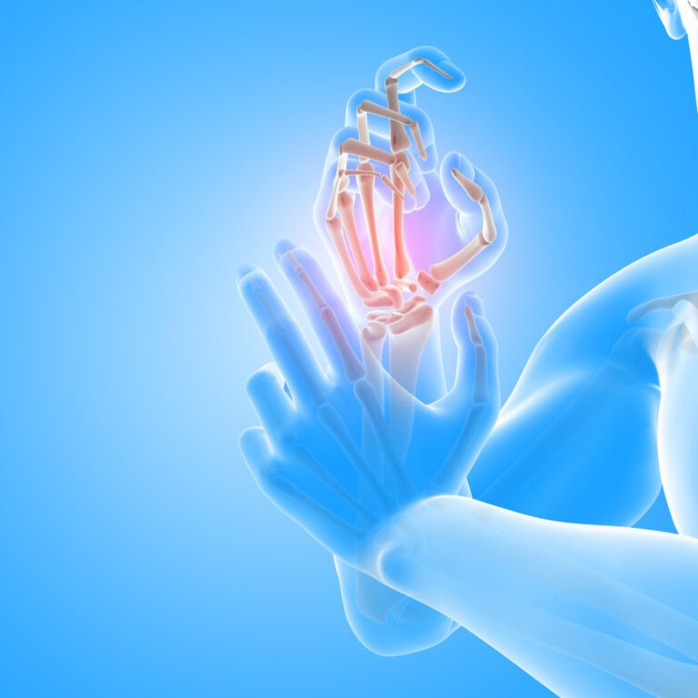How Can Vitamin D Help Relieve Your Rheumatoid Arthritis?