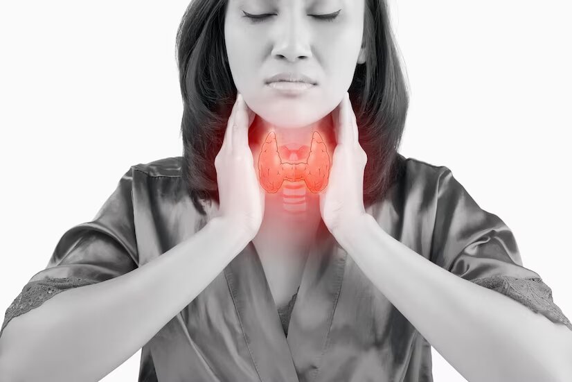 Thyroid illustration representing Hashimoto's thyroiditis and thyroid conditions