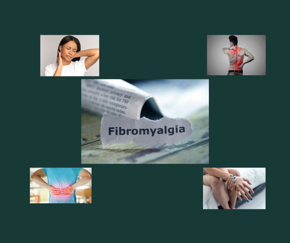 Treating Fibromyalgia with Orthomolecular Medicine: The Role of Vitamin D, Thiamine, and Other Co-factors Treating Fibromyalgia with Orthomolecular Medicine: The Role of Vitamin D, Thiamine, and Other Co-factors