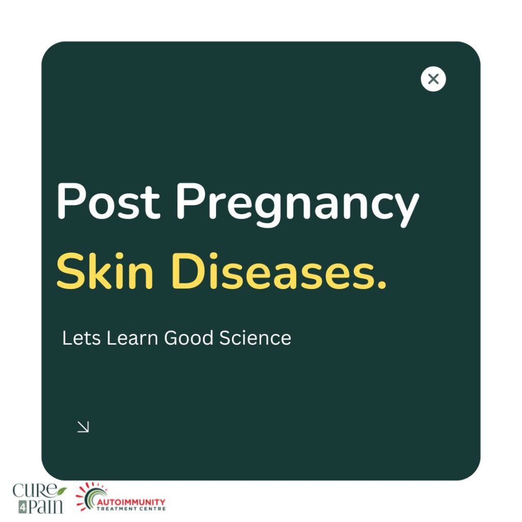 Understanding Psoriasis and Its Impact During Pregnancy
